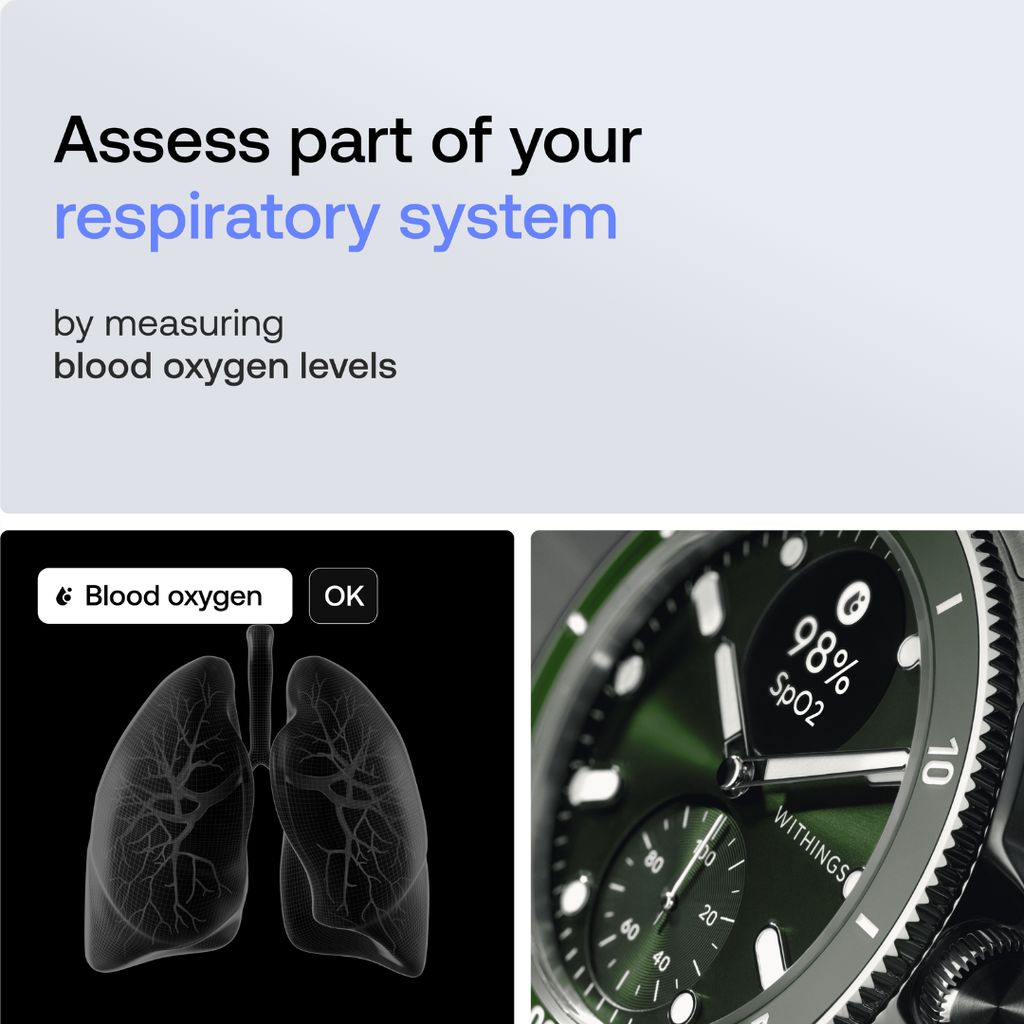 Scanwatch Nova - Grün - Image 4