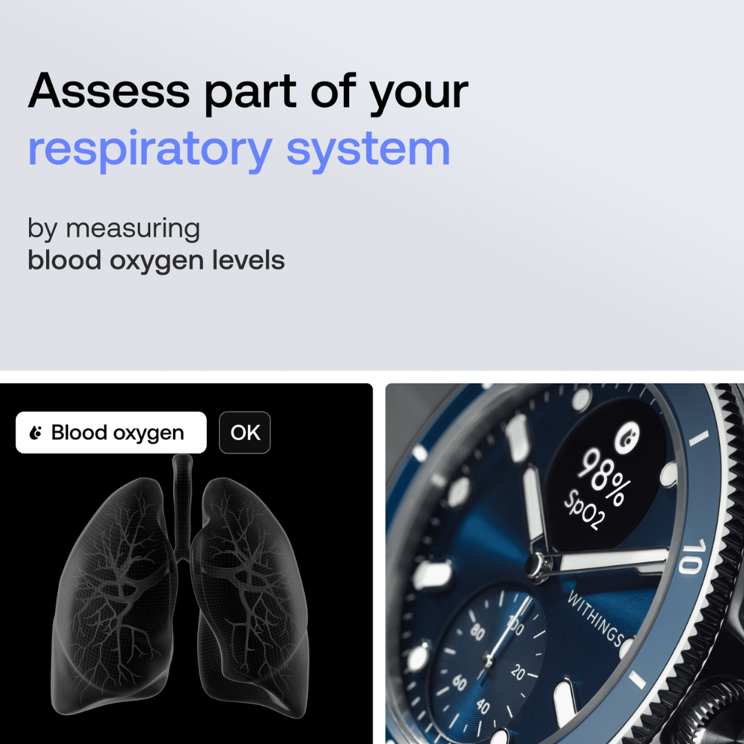 ScanWatch Nova – Blau - Image 4