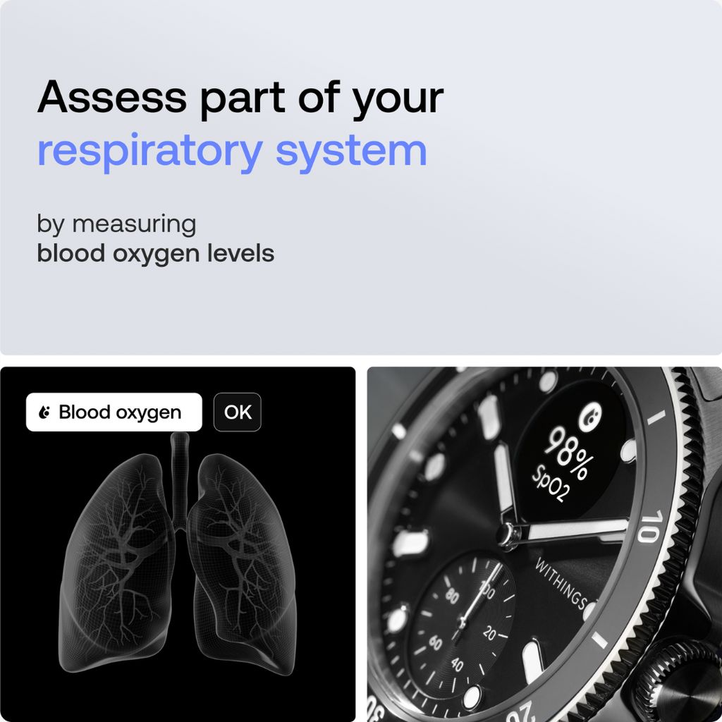 Scanwatch Nova – Schwarz - Image 4